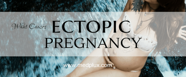 Ectopic Pregnancy Symptoms Ruptured Signs Causes Treatment