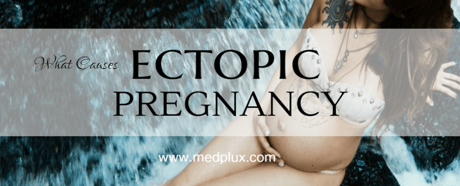 Ectopic Pregnancy Symptoms Ruptured Signs Causes Treatment