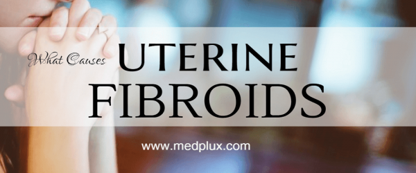Uterine Fibroids Symptoms, Causes and Treatment