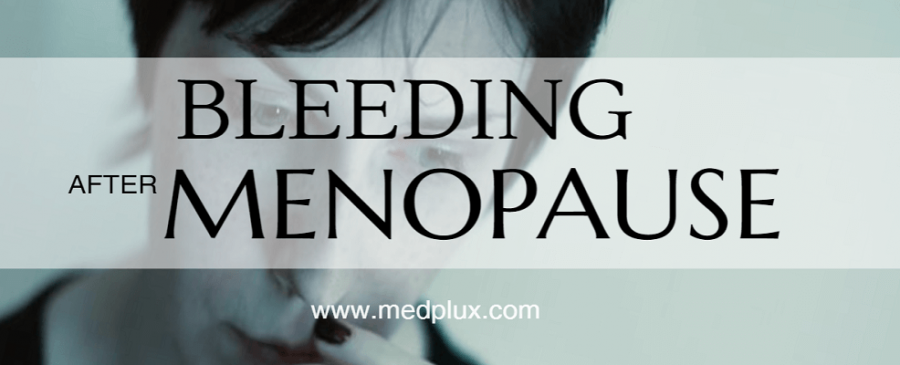 Postmenopausal bleeding Causes, Treatment and Cure