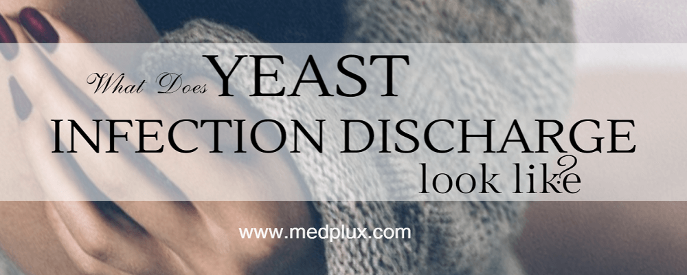 Yeast Infection Discharge: Causes, Treatment | Medplux