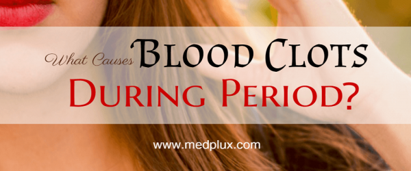 period blood clots during period