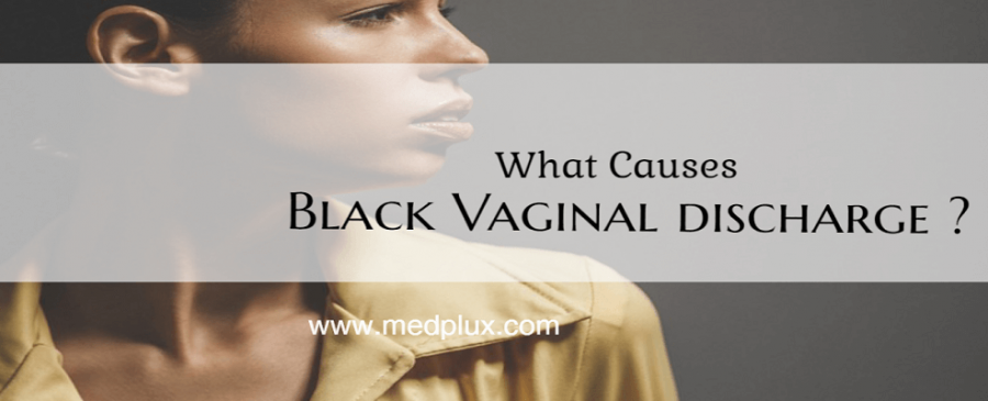 Black discharge from vagina before or after period