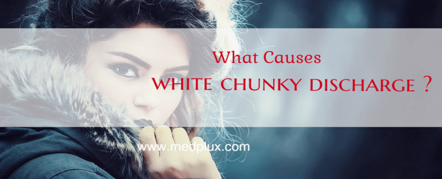 White chunky discharge no odor no itch