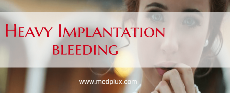 Can Implantation Bleeding Be Heavy And Be Like Period