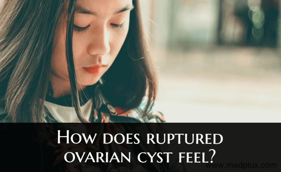 what does it feel like when an ovarian cyst ruptures 