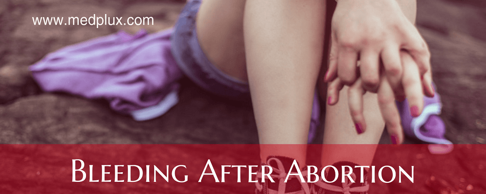 Bleeding After Abortion How Long Does It Last Easy Ways To Stop It