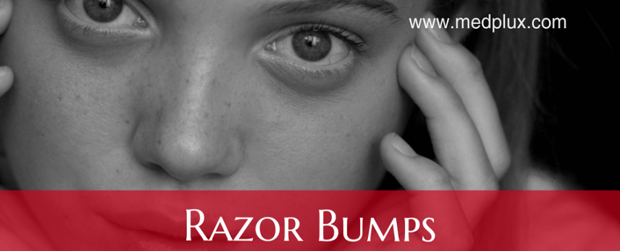 razor bumps