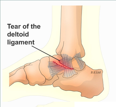 medial foot pain